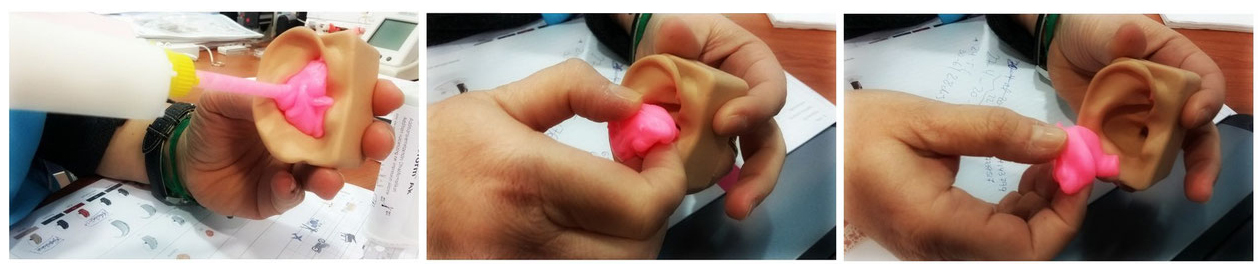 Toma de impresión del canal auditivo toma de impresión del oído